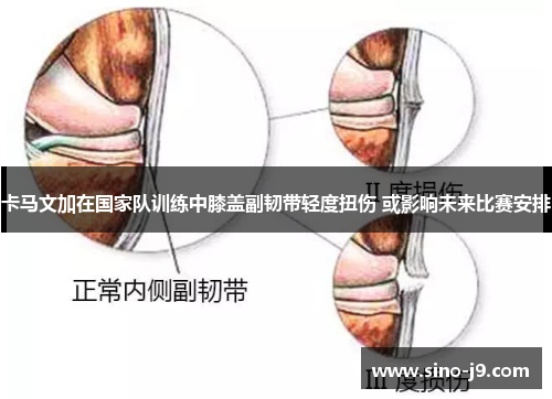 卡马文加在国家队训练中膝盖副韧带轻度扭伤 或影响未来比赛安排